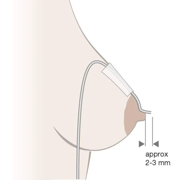 Medela Supplemental Nursing System